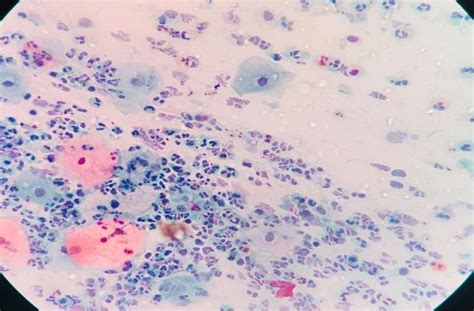 what is coccobacilli in pap smear|Reliability of conventional Papanicolaou smear in diagnosing bacterial.